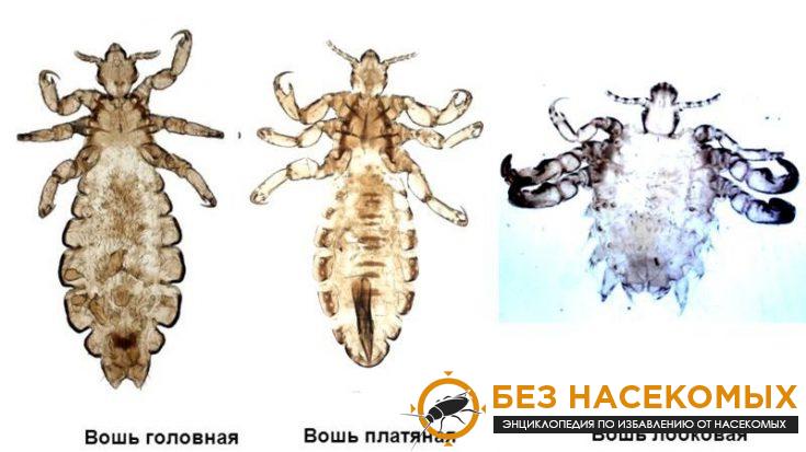 5-5-735x413-1 Платяной педикулез: что это такое?