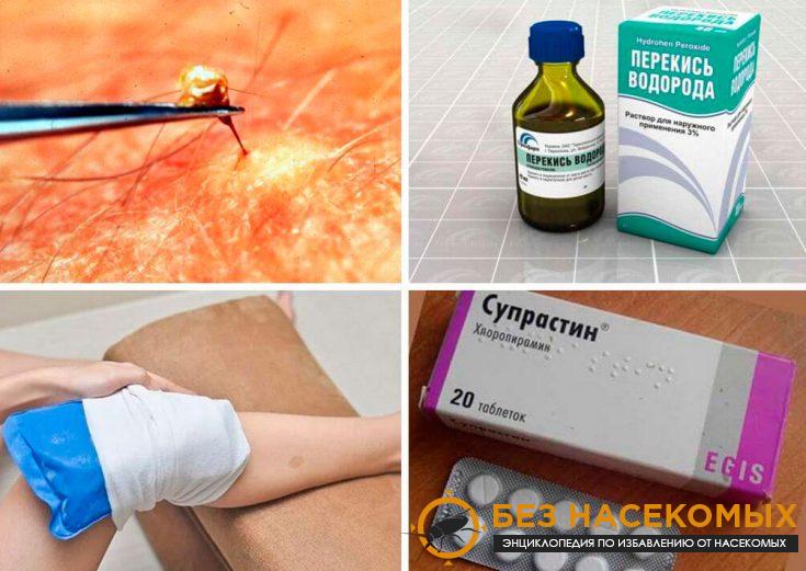 Первая помощь при укусе